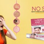 no scars cream for pimples.