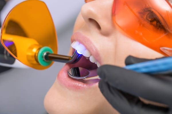 The Top 10 Benefits Of Dental Implants