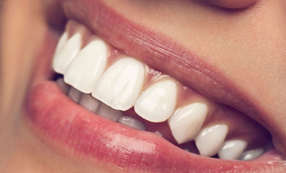 How Often Can I Whiten My Teeth?